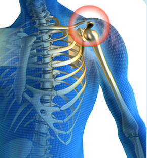 shoulder stability exercise
